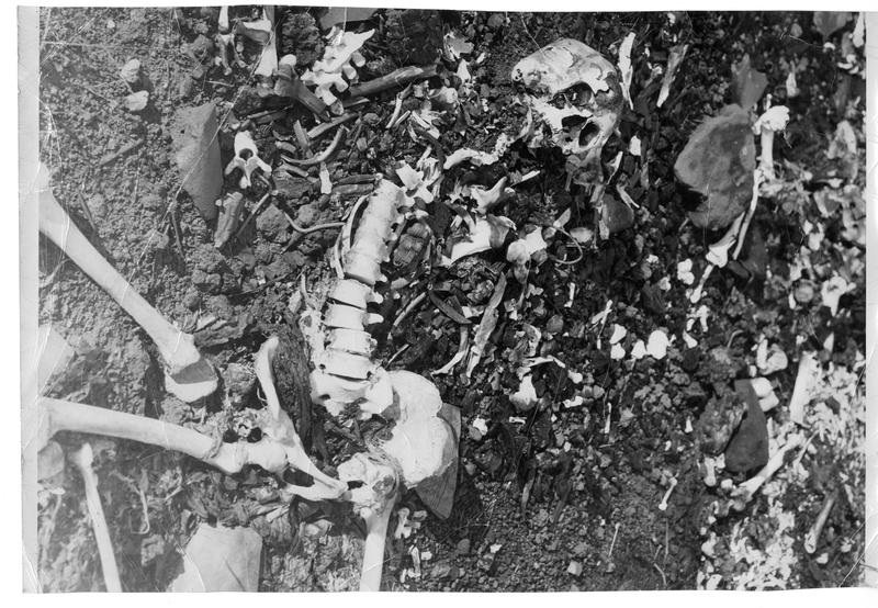 Fragmented Human Skeleton Left By The Atomic Bomb In Nagasaki Japan Harry S Truman