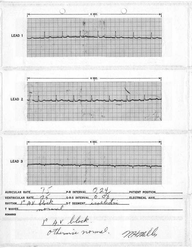Electrocardiographic Report for Former President Harry S. Truman