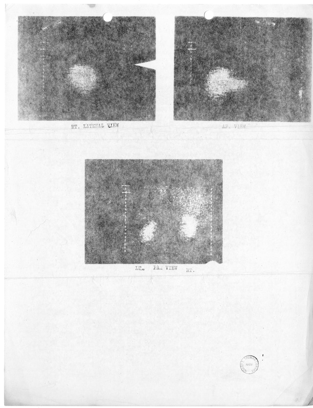 Radioisotope Report for Former President Harry S. Truman