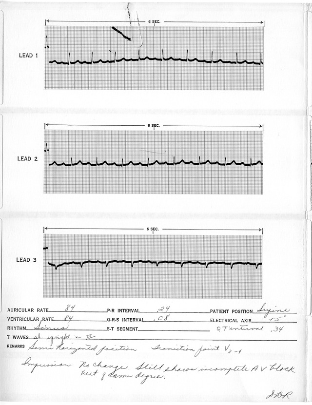 Electrocardiographic Report for Former President Harry S. Truman